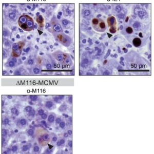 Anti-M116 (MCMV) antibody - clone M116.02